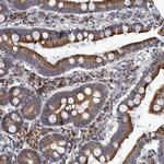 NAT16 Antibody in Immunohistochemistry (Paraffin) (IHC (P))