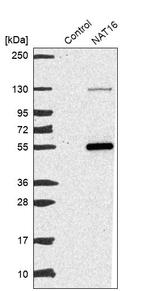 NAT16 Antibody in Western Blot (WB)