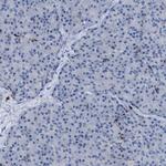 SLC47A1 Antibody in Immunohistochemistry (Paraffin) (IHC (P))