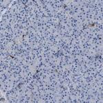 SLC47A1 Antibody in Immunohistochemistry (IHC)