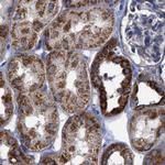 MECR Antibody in Immunohistochemistry (IHC)