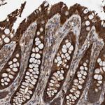 ABCA5 Antibody in Immunohistochemistry (Paraffin) (IHC (P))