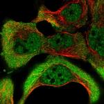 NKTR Antibody in Immunocytochemistry (ICC/IF)