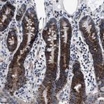 NKTR Antibody in Immunohistochemistry (Paraffin) (IHC (P))