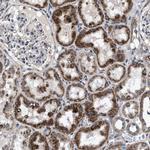 NKTR Antibody in Immunohistochemistry (Paraffin) (IHC (P))