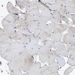 NKTR Antibody in Immunohistochemistry (Paraffin) (IHC (P))