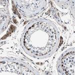 NKTR Antibody in Immunohistochemistry (IHC)