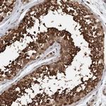 Synip Antibody in Immunohistochemistry (IHC)