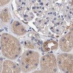 PFAS Antibody in Immunohistochemistry (IHC)