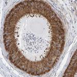 CDK5RAP3 Antibody in Immunohistochemistry (IHC)