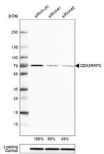 CDK5RAP3 Antibody in Western Blot (WB)