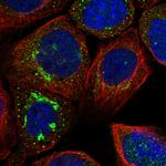 ATP6V0A1 Antibody in Immunocytochemistry (ICC/IF)