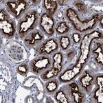 ATP6V0A1 Antibody in Immunohistochemistry (Paraffin) (IHC (P))