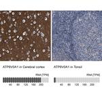 ATP6V0A1 Antibody