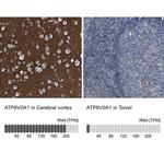 ATP6V0A1 Antibody