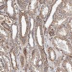 PKD1L1 Antibody in Immunohistochemistry (IHC)