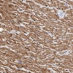 PKD1L1 Antibody in Immunohistochemistry (IHC)