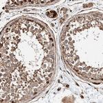 PKD1L1 Antibody in Immunohistochemistry (IHC)