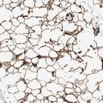 PKD1L1 Antibody in Immunohistochemistry (IHC)