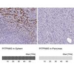 PITPNM3 Antibody in Immunohistochemistry (IHC)