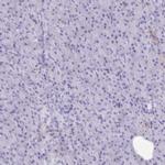 PITPNM3 Antibody in Immunohistochemistry (IHC)