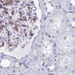 PITPNM3 Antibody in Immunohistochemistry (IHC)