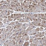 RSAD1 Antibody in Immunohistochemistry (IHC)