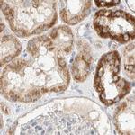 RNMTL1 Antibody in Immunohistochemistry (IHC)