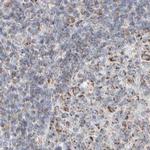 RNMTL1 Antibody in Immunohistochemistry (IHC)