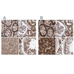 PECR Antibody in Immunohistochemistry (IHC)