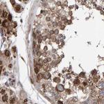 PECR Antibody in Immunohistochemistry (IHC)