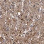 PECR Antibody in Immunohistochemistry (IHC)