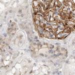 TOM1L2 Antibody in Immunohistochemistry (IHC)