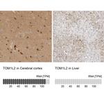 TOM1L2 Antibody