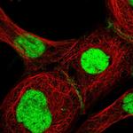 GTF2F1 Antibody in Immunocytochemistry (ICC/IF)