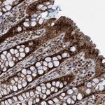 GTF2F1 Antibody in Immunohistochemistry (Paraffin) (IHC (P))