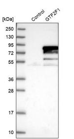 GTF2F1 Antibody in Western Blot (WB)