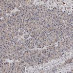 CANT1 Antibody in Immunohistochemistry (IHC)