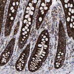 MRPL12 Antibody in Immunohistochemistry (Paraffin) (IHC (P))