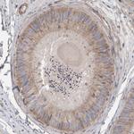 CDK5RAP3 Antibody in Immunohistochemistry (IHC)