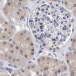 PFAS Antibody in Immunohistochemistry (IHC)