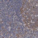 PFAS Antibody in Immunohistochemistry (IHC)