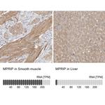 MPRIP Antibody in Immunohistochemistry (IHC)