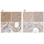 MPRIP Antibody in Immunohistochemistry (IHC)