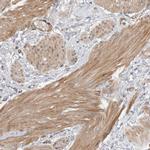 MPRIP Antibody in Immunohistochemistry (IHC)