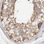 MPRIP Antibody in Immunohistochemistry (IHC)