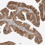 LLGL2 Antibody in Immunohistochemistry (Paraffin) (IHC (P))