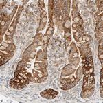 LLGL2 Antibody in Immunohistochemistry (Paraffin) (IHC (P))