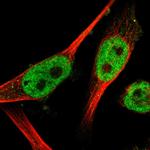 WIZ Antibody in Immunocytochemistry (ICC/IF)