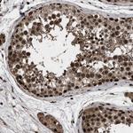 WIZ Antibody in Immunohistochemistry (Paraffin) (IHC (P))